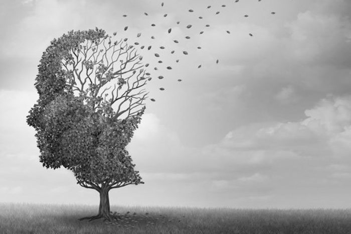 Alzheimer