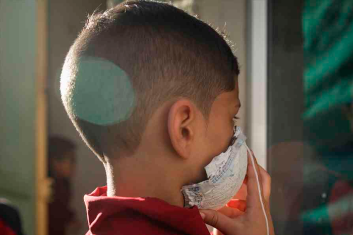 Niños. Corovavirus