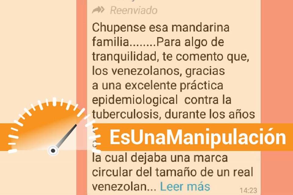 espaja vacuna bcg