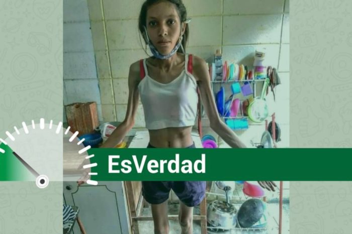 EsPaja joven desnutrición severa