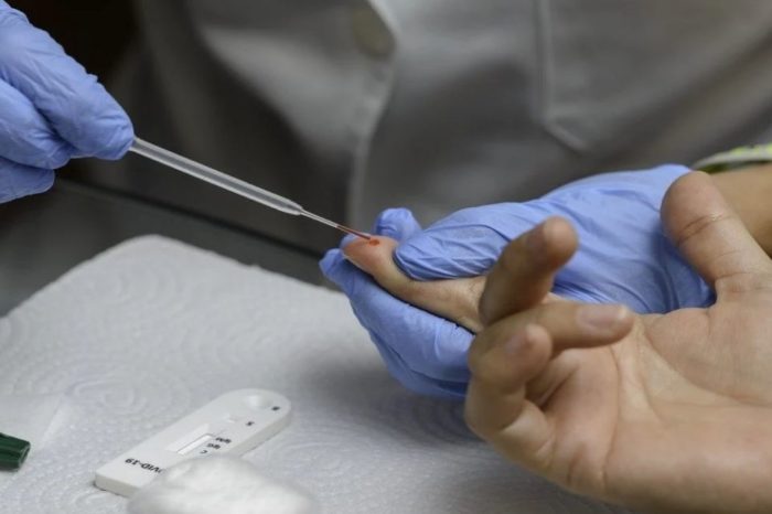 Prueba rápida para covid-19