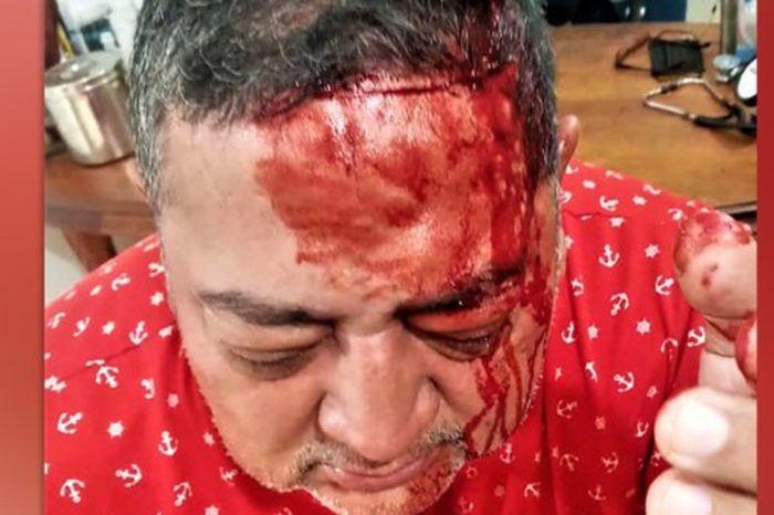 Harold Maldonado Primero Justicia guerrilla FBL Barinas