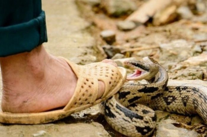 Mordedura de serpiente Lara
