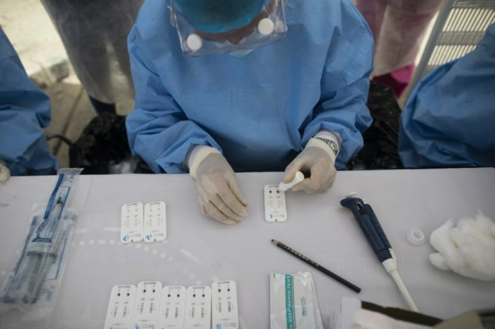 Médico prueba covid-19