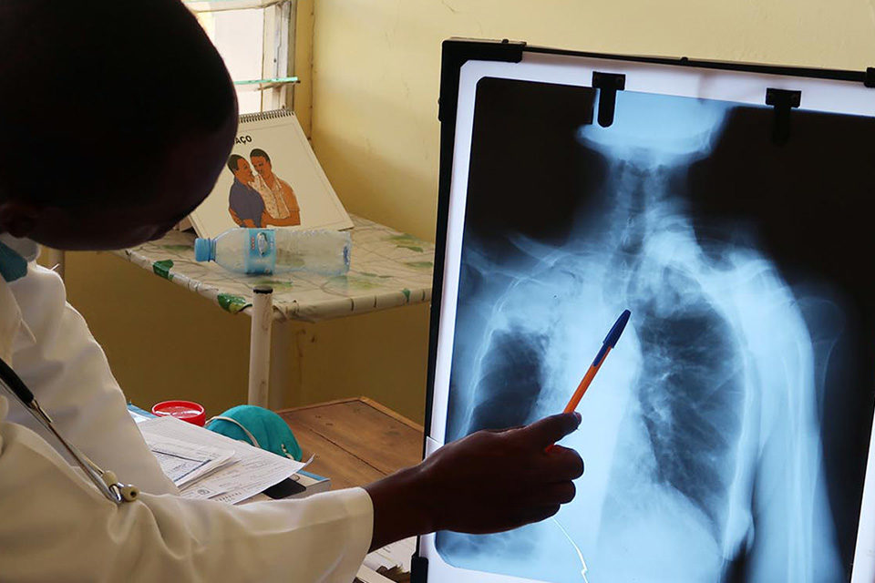 tuberculosis