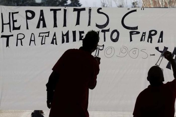hepatitis C