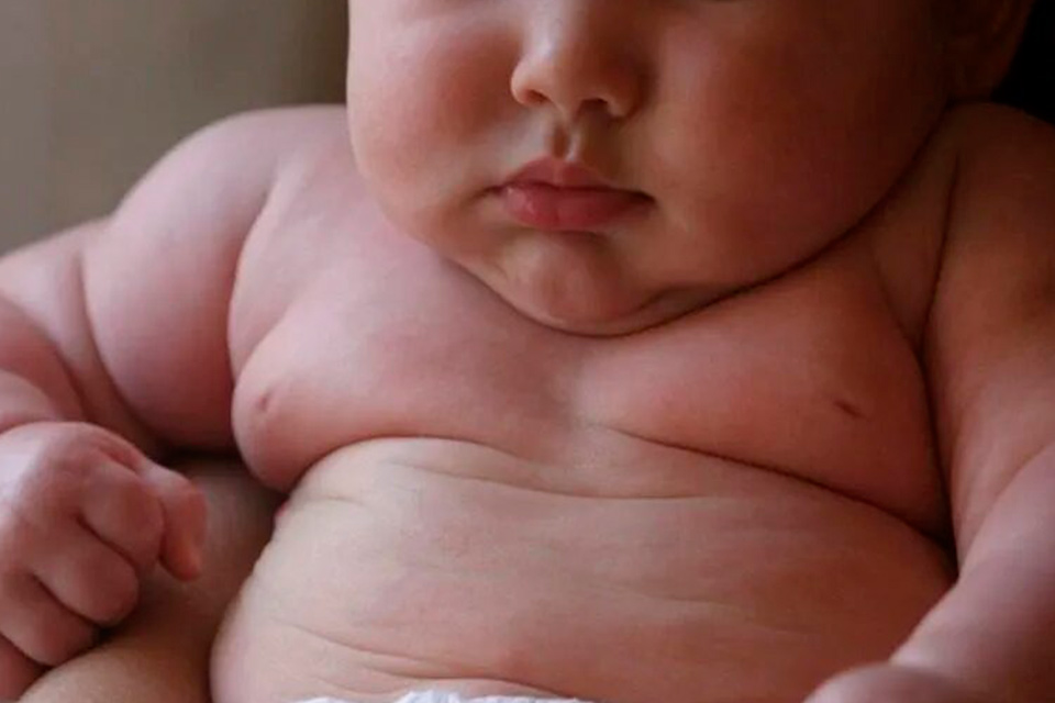 La obesidad y el impacto de una crisis en aumento